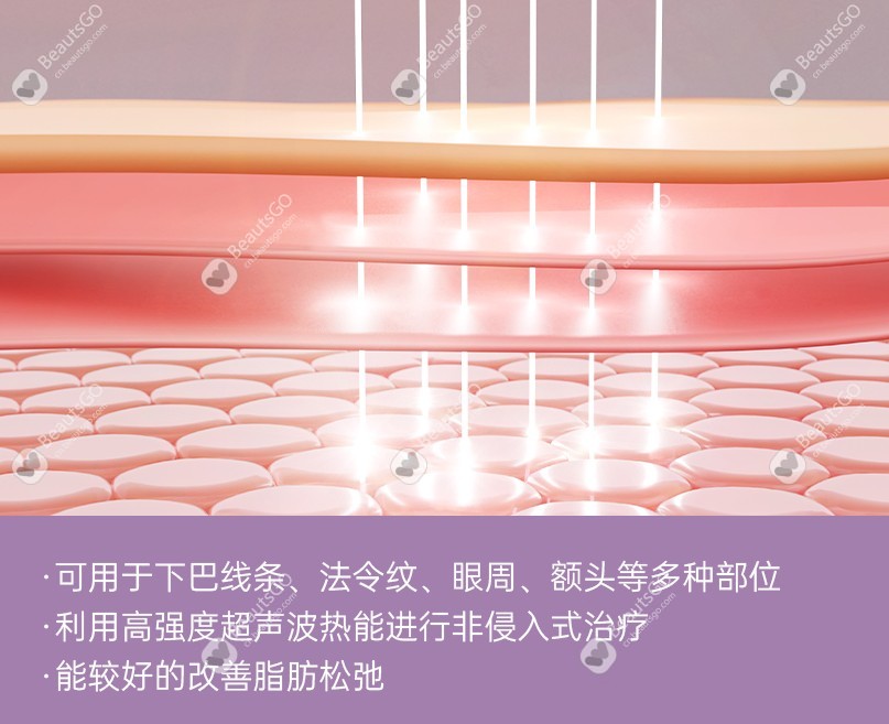 韩国美版超刀价格是多少？在BeautGO APP获取美刀300/400/600发详细价格