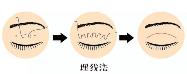 三、丽婷整形外科特色项目到底好在哪？