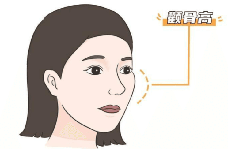 四、韩国GOODLINE整形外科磨颧骨赴韩路线与周边住宿怎么安排