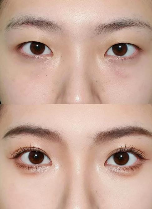 济州THE FIRST整形外科李载胜技术稳吗？31年专攻切开双眼皮，BeautsGO可查案例